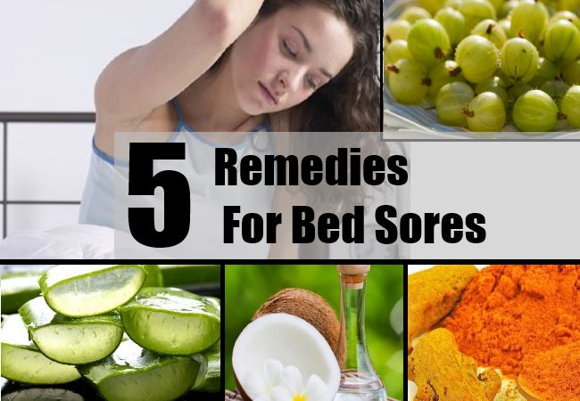 What Should You Do For Bed Sores