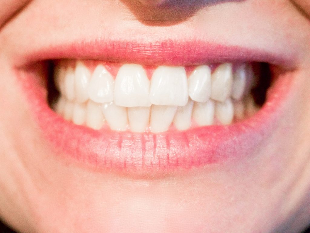 4 Signs You Have Gum Disease and Ways To Treat It